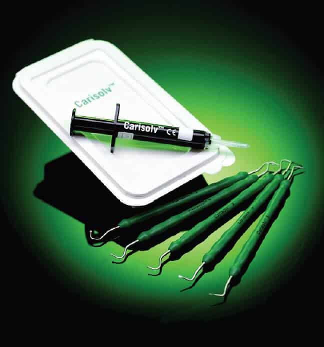 The Carisolv® system dissolves dental tissue with caries in a very controlled and conservative manner, without damaging surrounding healthy tissue The Carisolv® system dissolves dental tissue with caries in a very controlled and conservative manner, without damaging surrounding healthy tissue