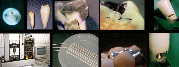 These are a sample of some of the images of a research carried out in the dental clinic Padrós with an electron microscope and that was published in one of the national and foreign scientific journals These are a sample of some of the images of a research carried out in the dental clinic Padrós with an electron microscope and that was published in one of the national and foreign scientific journals