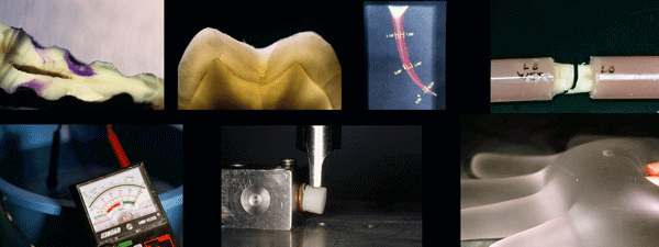These are a sample of some of the images of a research carried out in the dental clinic Padrós with an electron microscope and that was published in one of the national and foreign scientific journals These are a sample of some of the images of a research carried out in the dental clinic Padrós with an electron microscope and that was published in one of the national and foreign scientific journals