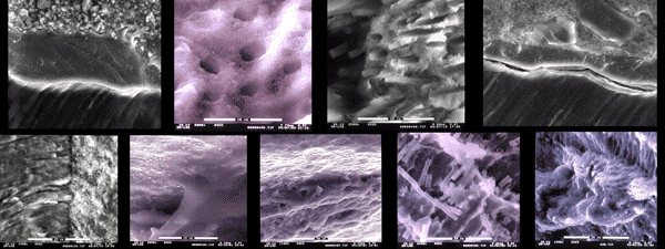 These are a sample of some of the images of a research carried out in the dental clinic Padrós with an electron microscope and that was published in one of the national and foreign scientific journals These are a sample of some of the images of a research carried out in the dental clinic Padrós with an electron microscope and that was published in one of the national and foreign scientific journals