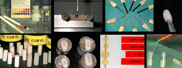 These are a sample of some of the images of a research carried out in the dental clinic Padrós with an electron microscope and that was published in one of the national and foreign scientific journals These are a sample of some of the images of a research carried out in the dental clinic Padrós with an electron microscope and that was published in one of the national and foreign scientific journals