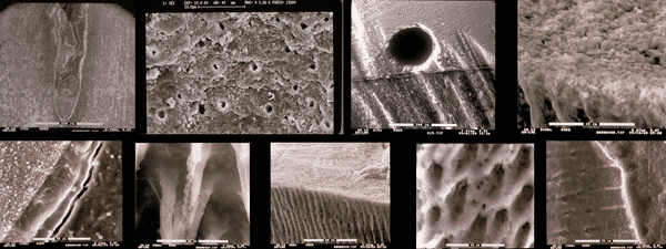 These are a sample of some of the images of a research carried out in the dental clinic Padrós with an electron microscope and that was published in one of the national and foreign scientific journals These are a sample of some of the images of a research carried out in the dental clinic Padrós with an electron microscope and that was published in one of the national and foreign scientific journals