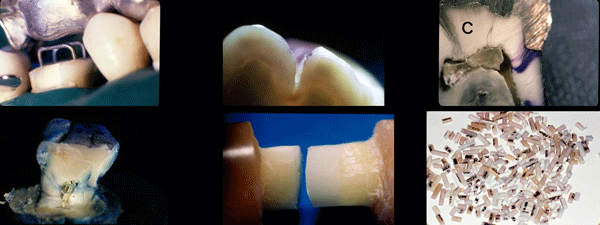 These are a sample of some of the images of a research carried out in the dental clinic Padrós with an electron microscope and that was published in one of the national and foreign scientific journals These are a sample of some of the images of a research carried out in the dental clinic Padrós with an electron microscope and that was published in one of the national and foreign scientific journals