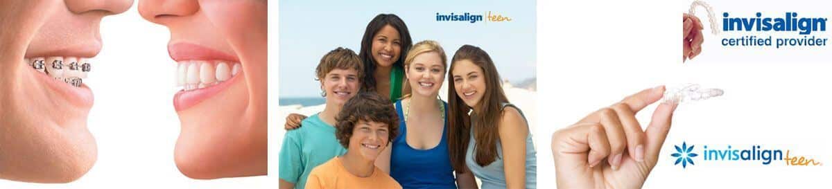 The Padrós dental clinic in Barcelona has the invisalign invisible orthodontic treatment, transparent and removable appliances The Padrós dental clinic in Barcelona has the invisalign invisible orthodontic treatment, transparent and removable appliances