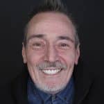 Joaquín dental case: aesthetic dental treatment