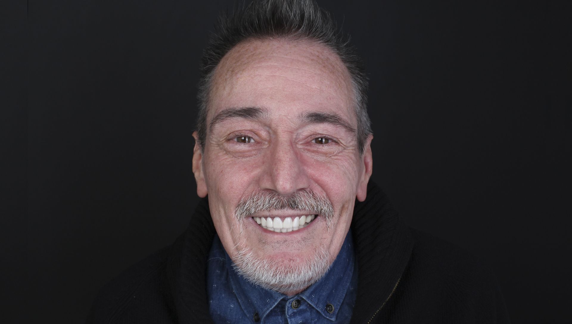 Joaquin after cosmetic dentistry treatment Joaquin after cosmetic dentistry treatment