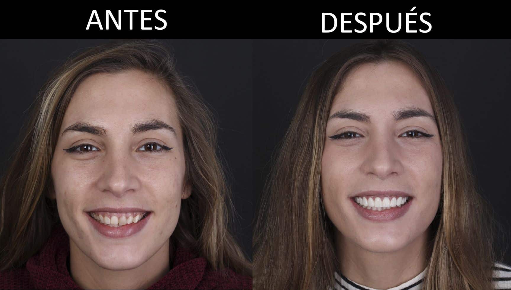 Before & after cosmetic dentistry treatment Before & after cosmetic dentistry treatment