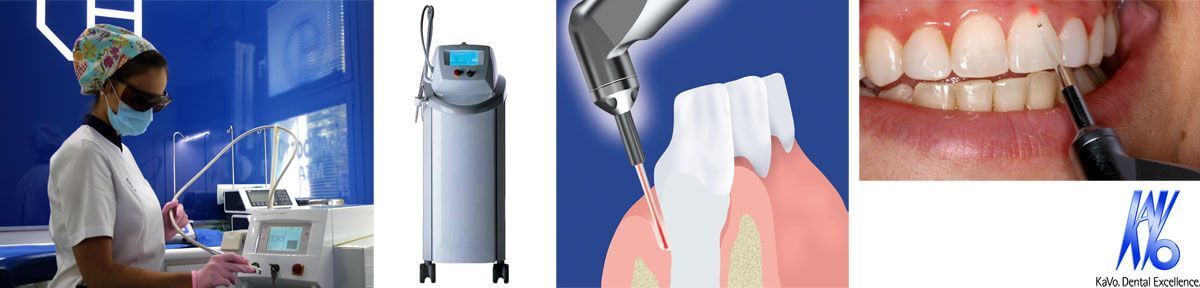 The Kavo dental laser is designed to treat soft and hard tissues. It has many applications in dentistry