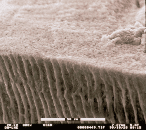 Photograph of tubules in teeth dentine as seen through an environmental scanning electron microscope (study by Clínica Dental Padrós) Photograph of tubules in teeth dentine as seen through an environmental scanning electron microscope (study by Clínica Dental Padrós)