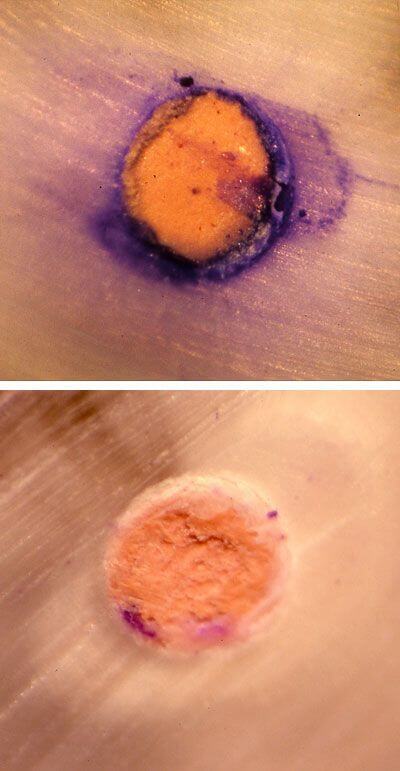 Images of the research carried out by dental clinic Padrós on the sealing of the conduits in endodontics