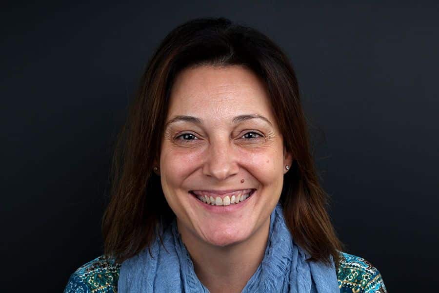 Before the study of dental aesthetics and the treatment of composite veneers Before the study of dental aesthetics and the treatment of composite veneers