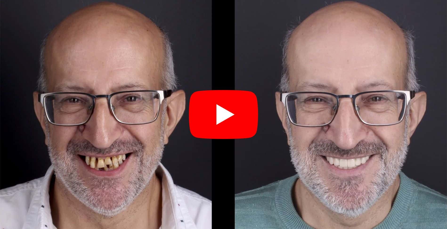 Video testimonials of patients treated at the Padrós Dental Clinic
