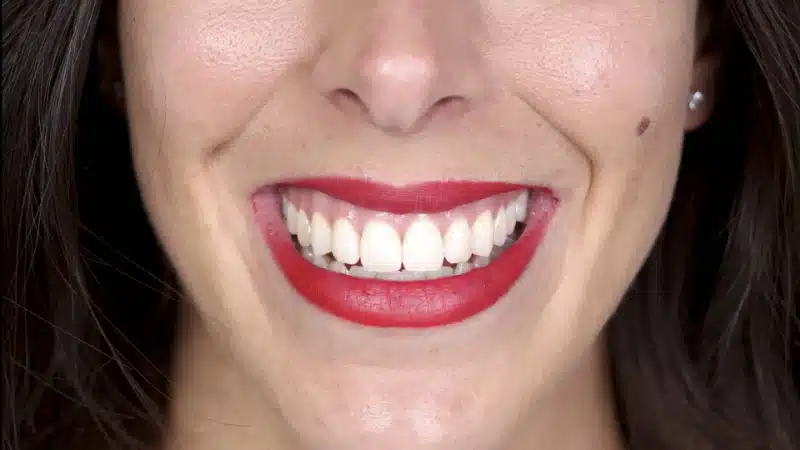 imagen de señorita maquillada con sonrisa impecable